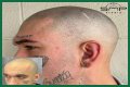 Unveiling The Truth: Steve Austin's Baldness Decoded