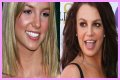 What’s Up with Britney Spears’ Smile? The Scoop on Her Noticeable Gap Teeth